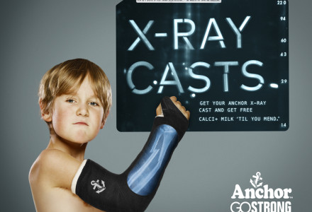 Anchor X-Ray Casts